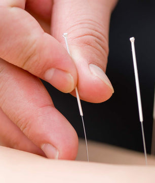 PhysioZool Acupuncture Dry Needles Sterile Disposable with Guide Tube Physiotherapy Trigger Point Needles