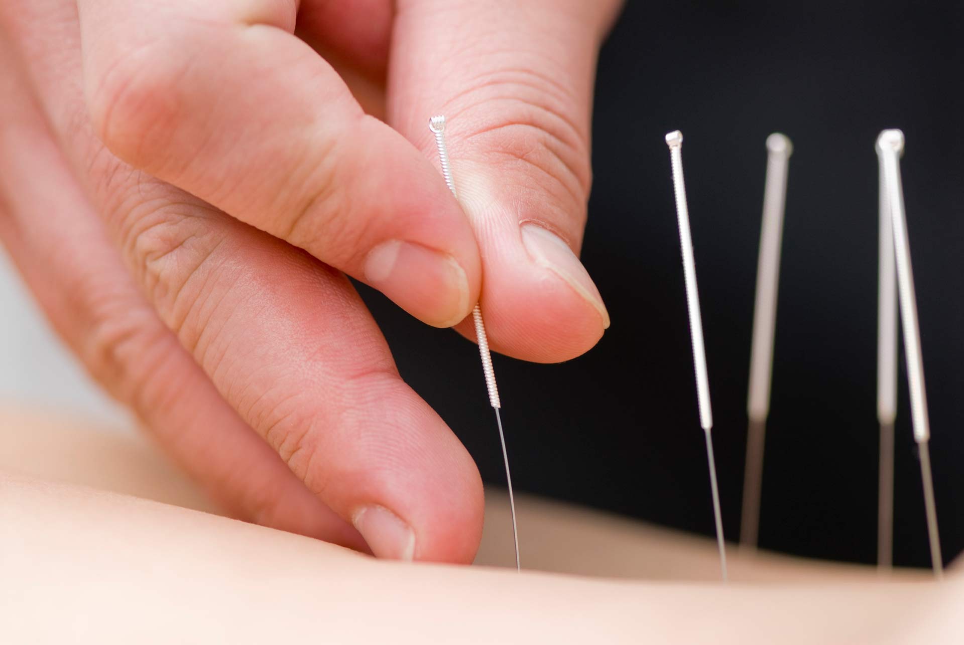 PhysioZool Acupuncture Dry Needles Sterile Disposable with Guide Tube Physiotherapy Trigger Point Needles